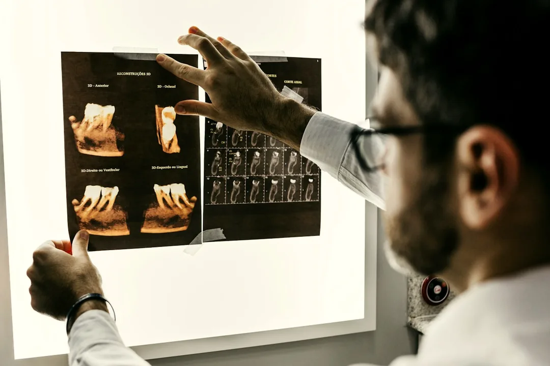 Clinician reviewing 3D dental CBCT scans on a light board