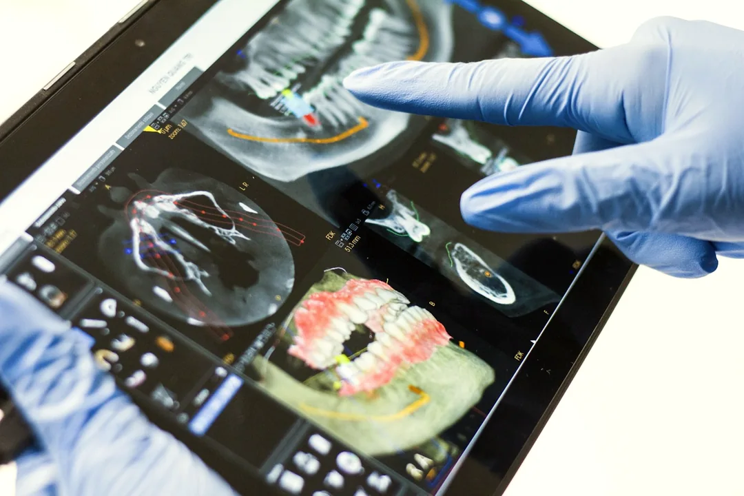 Clinician pointing to a 3D digital dental scan on a tablet screen